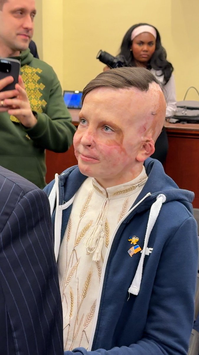 After surviving a Russian attack in 2022, this 11-year-old Ukrainian boy has now traveled to the US to lobby for continued American support for his country.