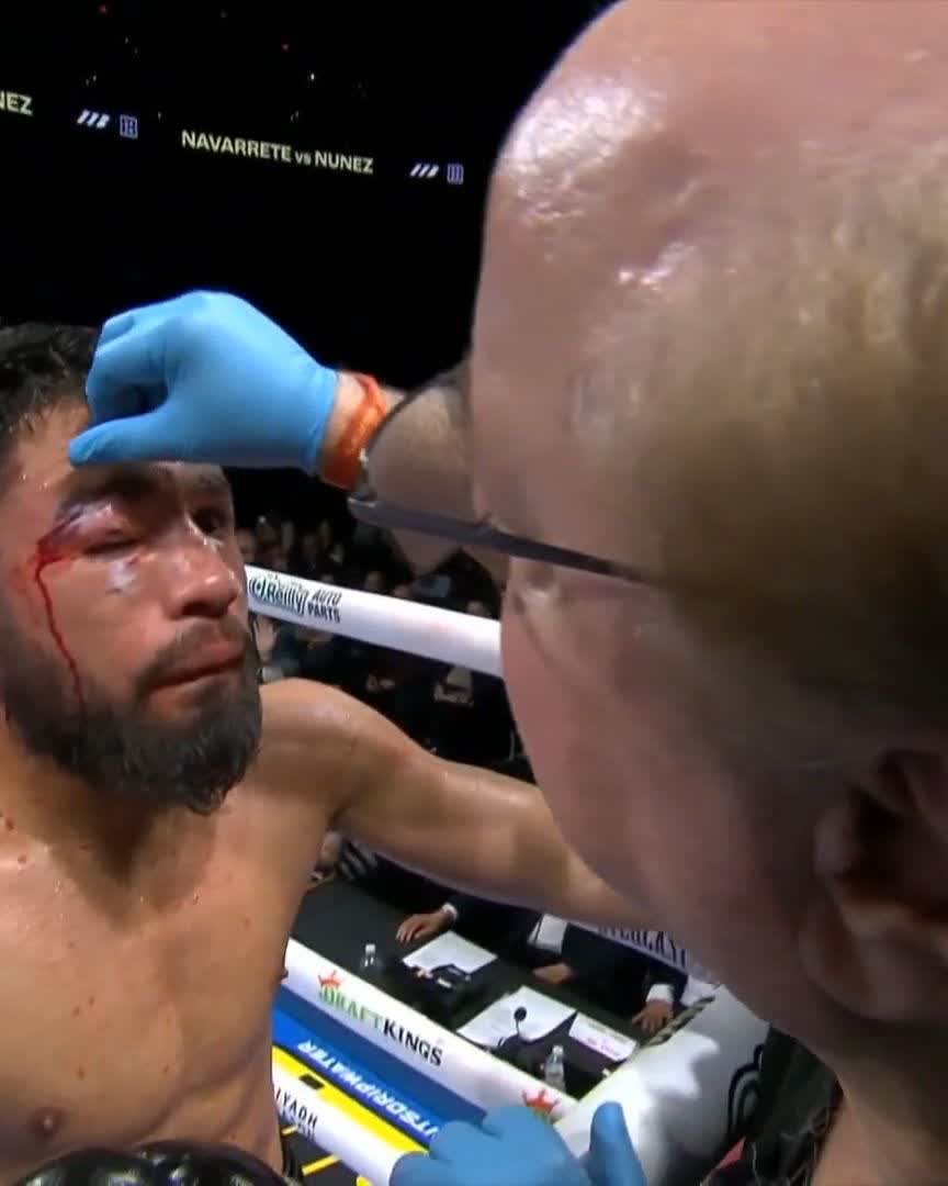 The doctor has seen enough. Congratulations, Emanuel Navarrete 👏 Now the the WBO and IBF World Super Featherweight Champion 👑👑 Another big moment in the career of the three-division World Champion’s career 🔥 #NavarreteNunez