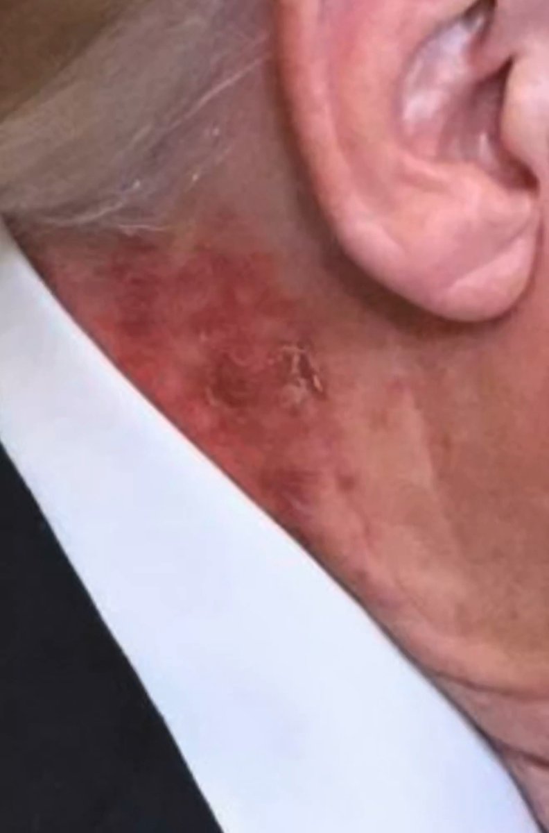 Donald Trump‘s health clearly isn’t well. It’s scary that this is the guy leading us into war. Any thoughts?