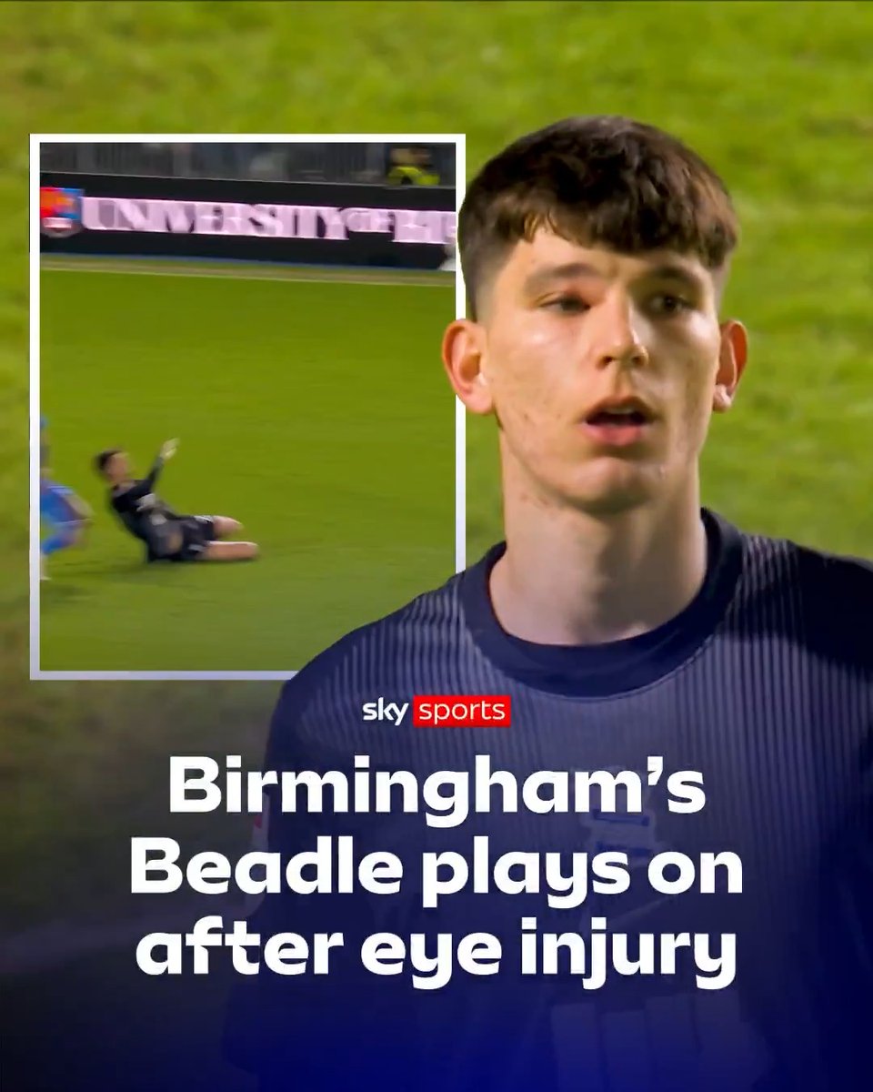 Birmingham's James Beadle played a full 90 in the Blues' defeat to Middlesbrough last night, despite suffering this nasty injury to his eye in the first 20 minutes 🫣
