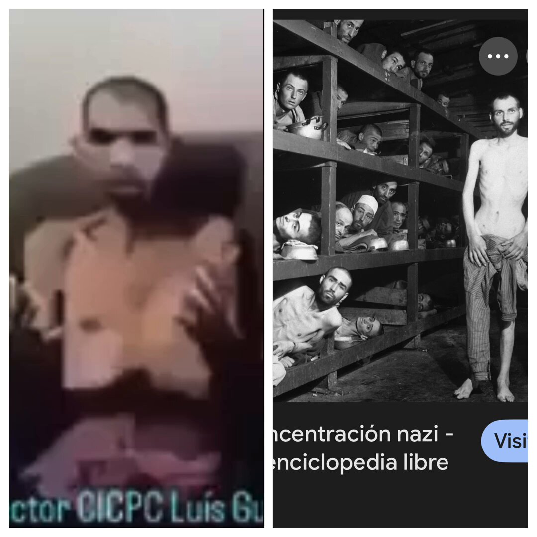 A la derecha los CAMPOS de CONCENTRACIÓN NAZI A la izquierda PRESO POLÍTICO de los CAMPOS de CONCENTRACIÓN de DELCY Delcy Rodríguez SALIÓ en LIBERTAD por ERROR Los que NO han SALIDO los están tratando de ENGORDAR para BORRAR los CRÍMENES de LESA HUMANIDAD Como TORTURA le ROBABAN la COMIDA🍽️que le llevaban las MADRES de los PRESOS POLÍTICOS