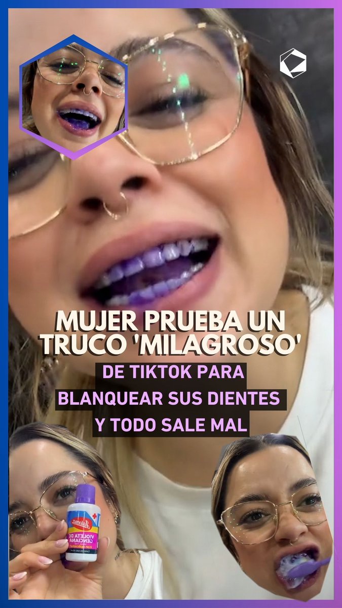 😂 De milagroso no tuvo nada… salvo el milagro de que todavía tiene dientes.