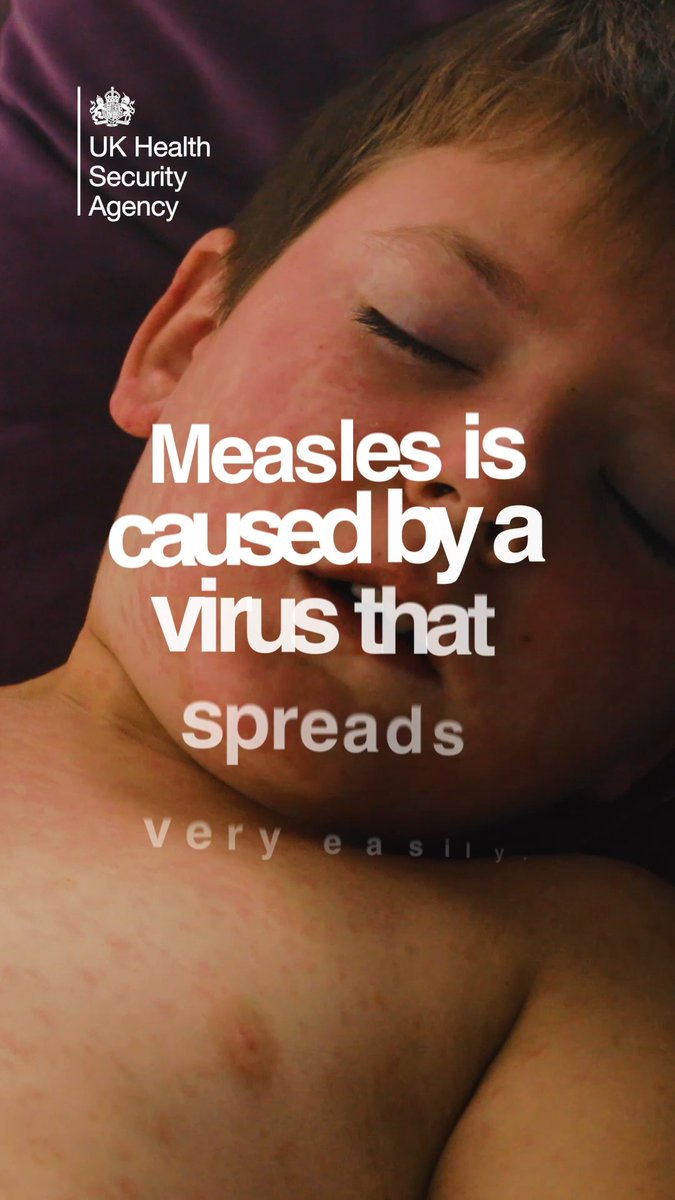 For more information on measles and how to protect yourself and your little ones, read our blog post. 🔗