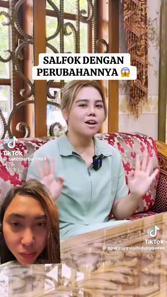 Spill geh treatment apa aja kaka ini selain oplas idung Kok kayak mahalini tbtb 😭