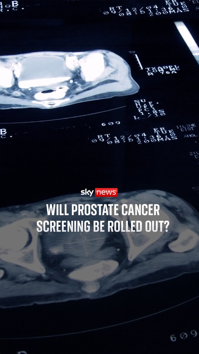 Sir Chris Hoy and Lord David Cameron, have both been diagnosed with the cancer and have called for the UK to introduce screening so more men are diagnosed at an earlier, treatable stage. 🔗