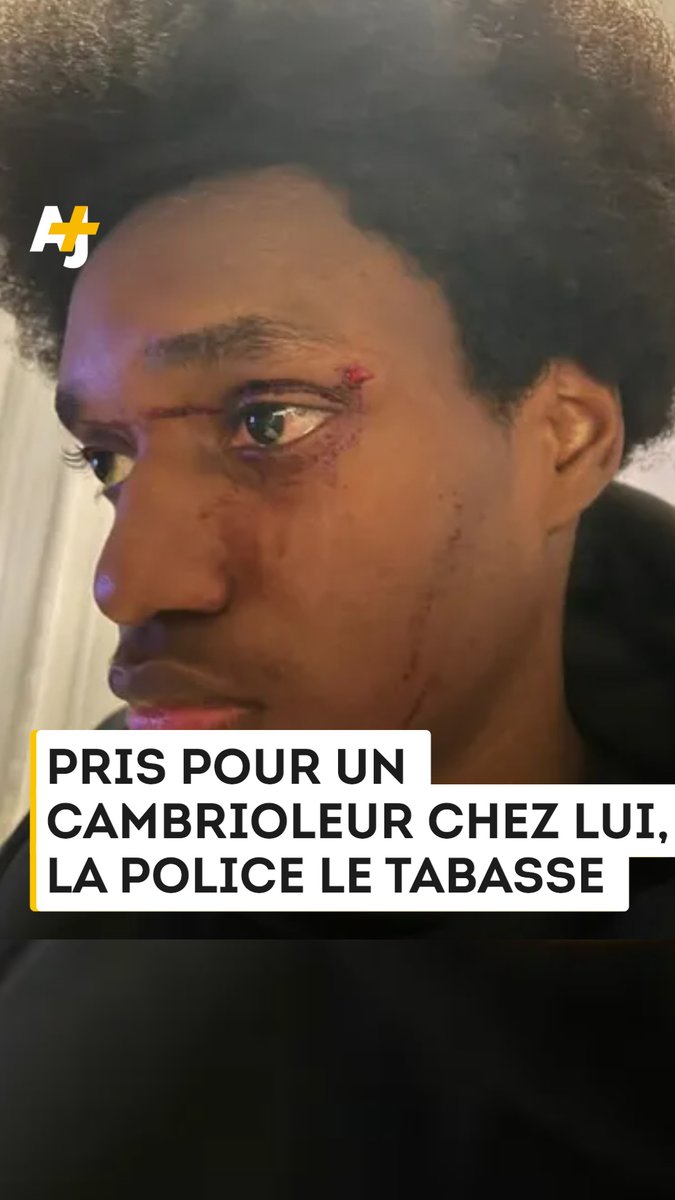 “Ils l'ont laissé en sang et sont partis comme des voleurs.” Des policiers rouent de coups un jeune homme chez lui, le prenant pour un cambrioleur.