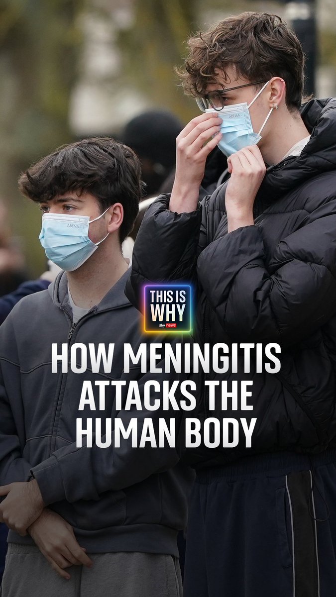 How does meningitis attack the human body? On #ThisIsWhy with @SkyNewsNiall, Dr Tom Nutt from Meningitis Now explains how the illness spreads, and how it affects those who catch it. 🎧 Click here to listen ➡️