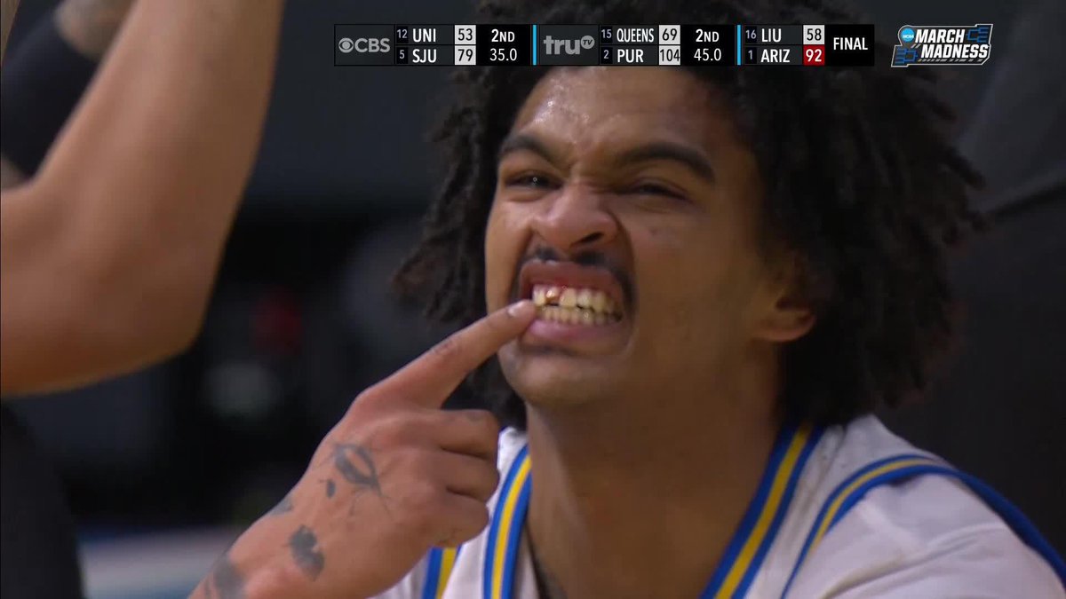 He lost part of his TOOTH on this play 😬