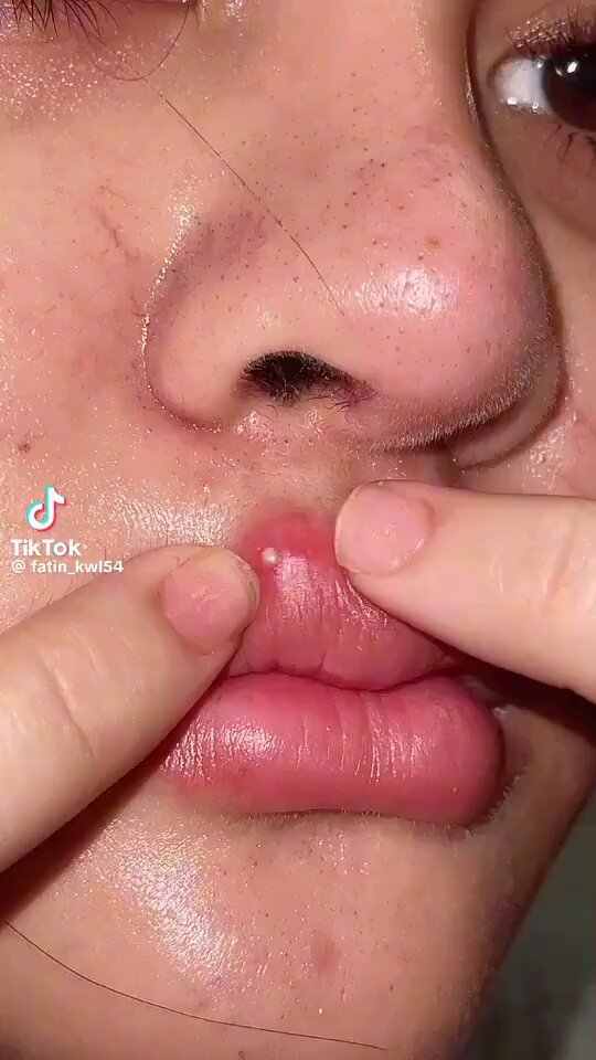 That’s painful 😣
