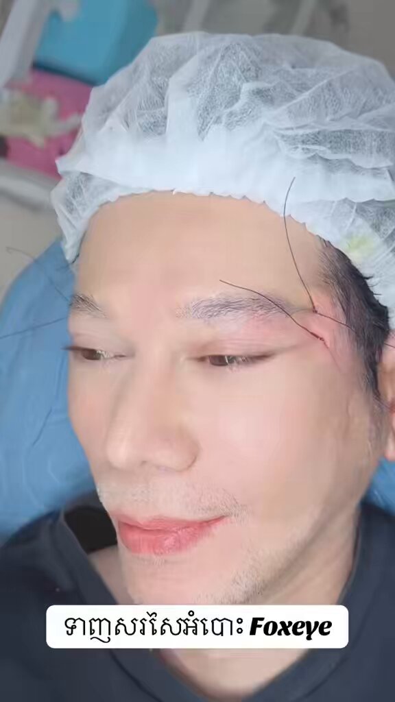 ទាញសរសៃអំបោះ Foxeye បងប្អូនអាចចុក Link ដើម្បីចូលតេលេក្រាមប្រឹក្សាជាមួយលោកគ្រូ