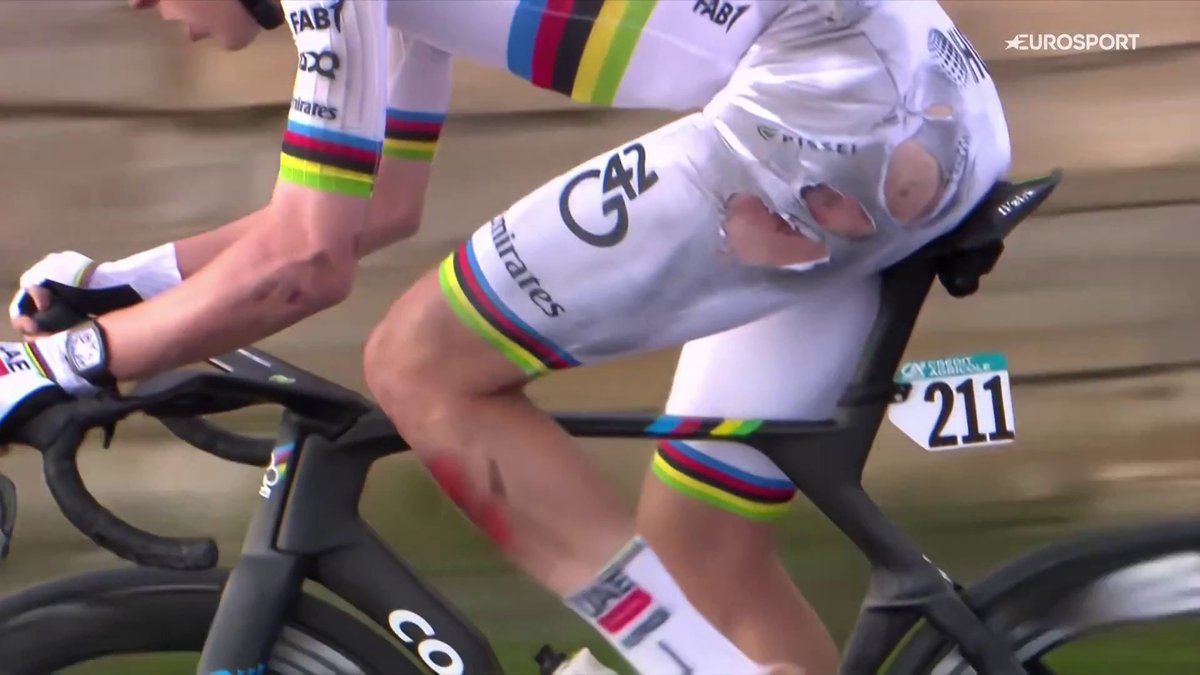 Las heridas de Pogacar. #MilanoSanremo
