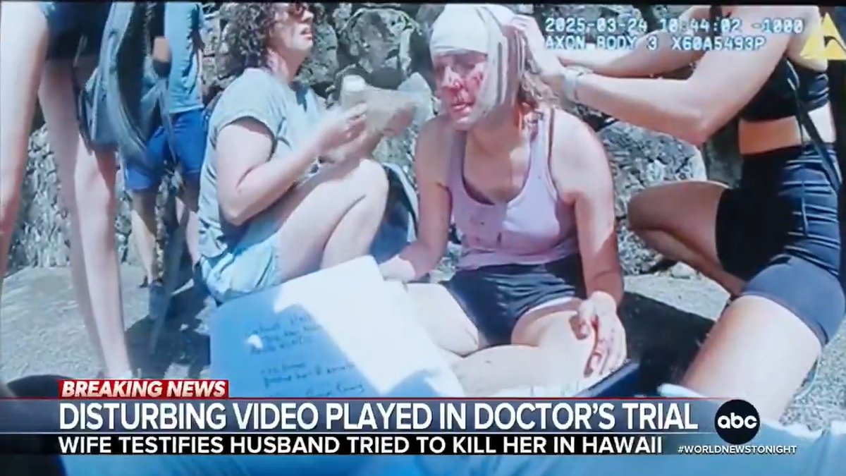 Body camera video was shown to the jury at the trial of a doctor accused of trying to kill his wife while hiking on a cliffside. Witnesses are seen leading her from the trail after she said her husband hit her head with a rock. Rhiannon Ally reports.