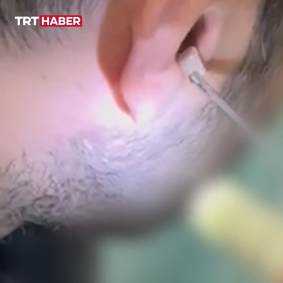 Kayseri’de polisin durdurduğu bir şahsın kulağında uyuşturucu madde bulundu.