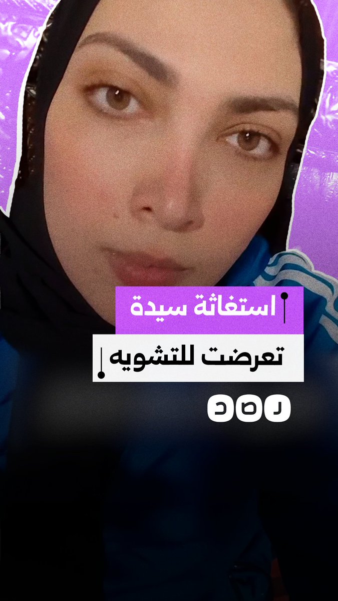 سيدة تستغيث بعد تعرضها للتشويه عبر التلاعب في صورها على مواقع التواصل