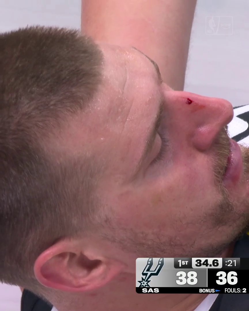 Wemby accidentally hits Jokic in the nose. The pair shakes hands afterwards 🤝
