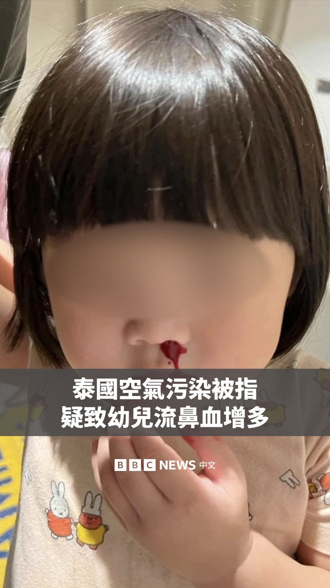 由于秸秆焚烧,泰国进入野火高发季,日益严重的雾霾加剧了人们对儿童健康的担忧。 BBC泰语部采访了两个家庭,他们的孩子出现了流鼻血的症状,他们认为这与空气污染引起的过敏有关。