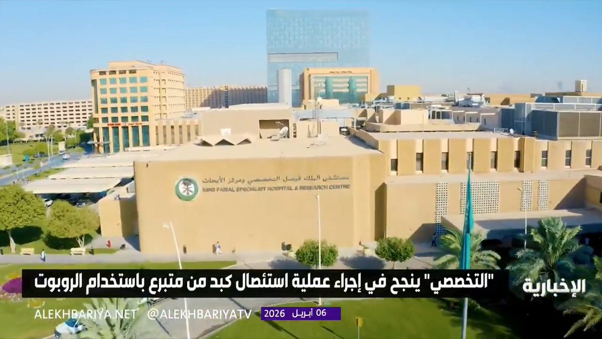 مستشفى الملك فيصل التخصصي ينجح في إجراء عملية استئصال كبد من متبرع باستخدام الروبوت