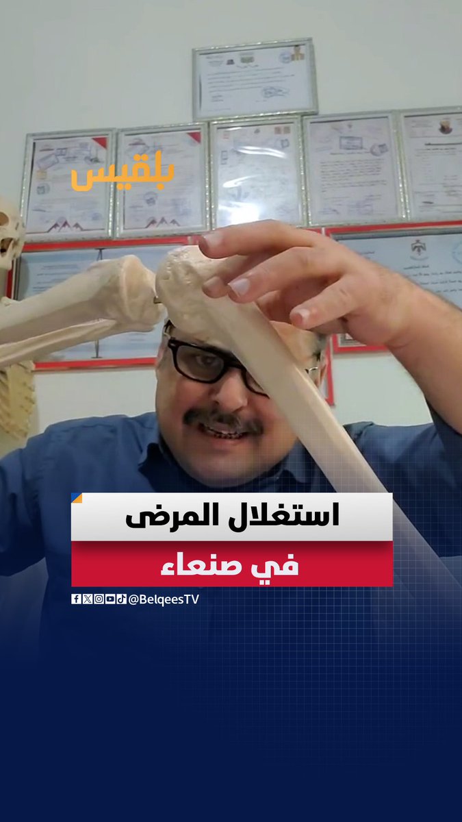 فجوة صادمة بين التكلفة الحقيقية وأسعار العلاج في #صنعاء: صفائح طبية لا تتجاوز قيمتها عشرات الدولارات تُباع بآلاف، وعمليات تُسعَّر بأرقام مبالغ فيها أين الرقابة ومن يحمي المرضى من هذا الاستغلال؟ #اليمن #منصات_بلقيس