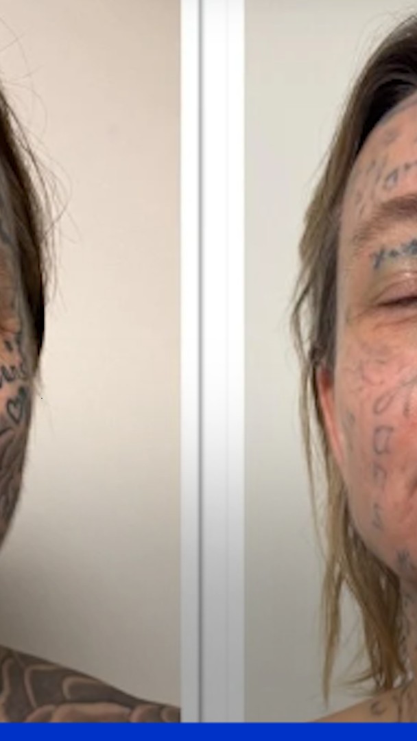 Au Pays-Bas, son compagnon l'a forcée à se faire tatouer 250 fois son prénom sur le corps