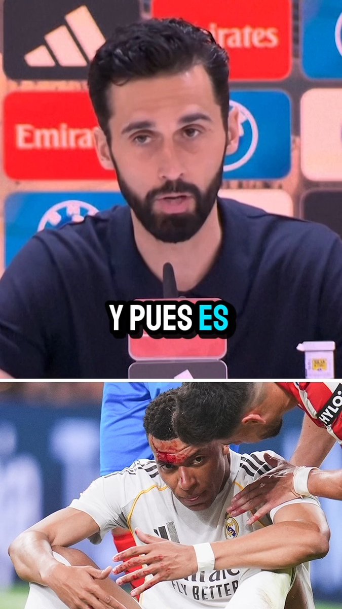 Álvaro Arbeloa sobre la acción sobre Mbappé en el minuto 89’ en el partido ante Girona: “Para mí es un penalti aquí y en la luna”