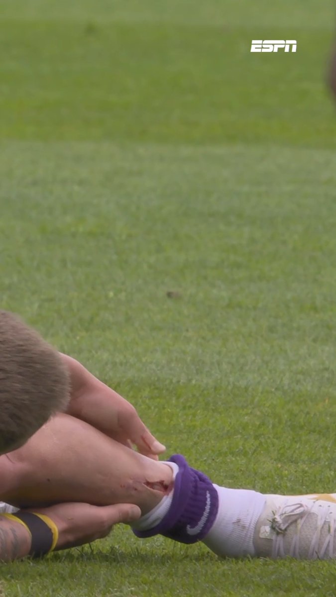 Imagine if we could invent something to go into footballer’s socks which would prevent injuries to their shins, just an idea.🧐