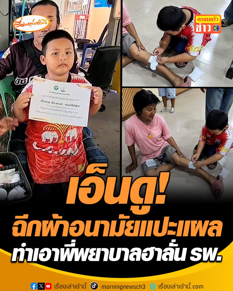 สุดทึ่ง! น้องนะโม 5 ขวบ สุดห่วงคุณย่าโดนสังกะสีบาดเลือดไหลไม่หยุด ฉีกผ้าอนามัยปิดแผลปฐมพยาบาลเบื้องต้นก่อนนำส่งโรงพยาบาล ทำเอาพี่พยาบาลฮาลั่น ผอ.ชื่นชม ฉลาดทำถูกวิธี พร้อมมอบใบประกาศเกียรติบัตร "หนูน้อยนักปฐมพยาบาล" #เรื่องเล่าเช้านี้ #ครอบครัวข่าว3 #ข่าวภูมิภาค #อยุธยา