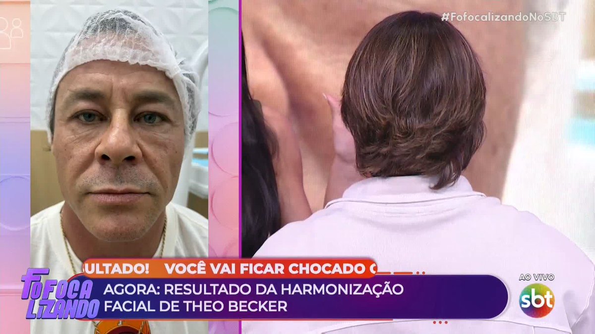 Veja o resultado da harmonização de Theo Becker! #FofocalizandoNoSBT
