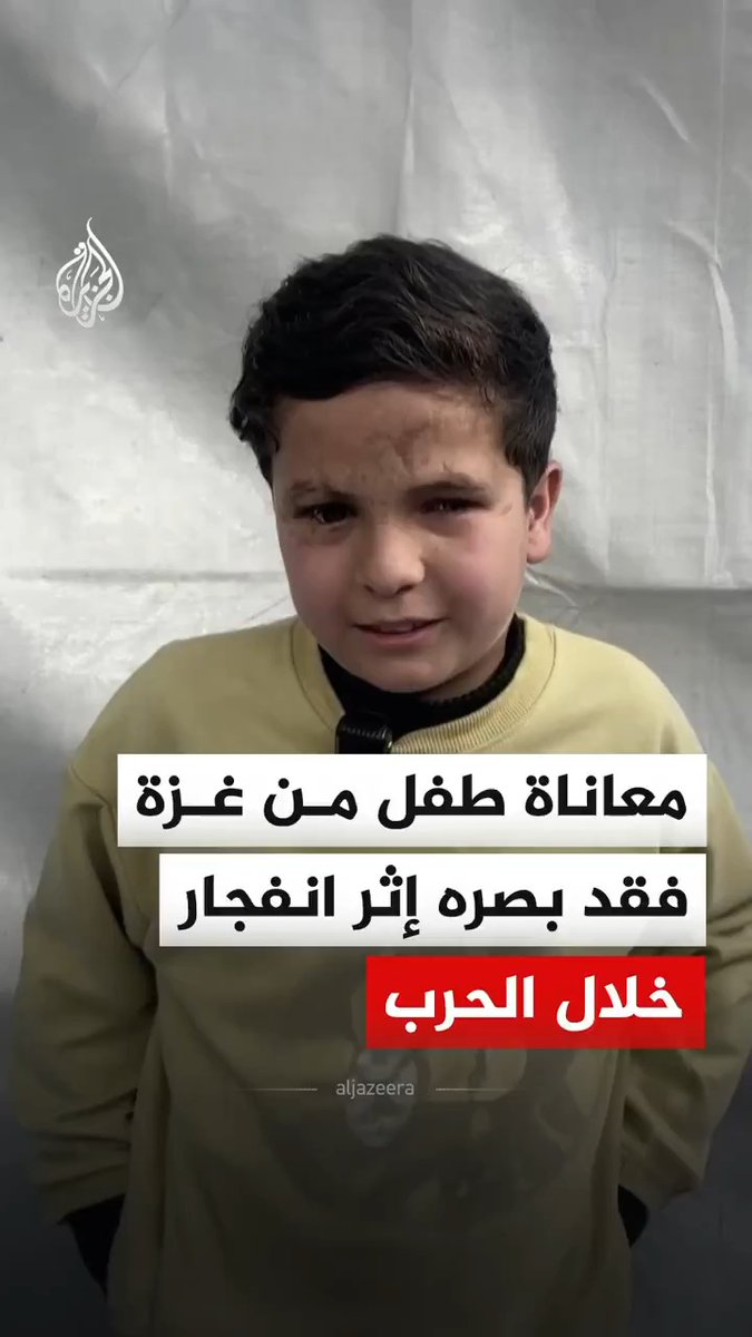 مشاهد من معاناة الطفل الفلسطيني محمد عودة، إذ فقد بصره إثر إصابته بانفجار جسم من مخلفات الاحتلال الإسرائيلي شمالي قطاع غزة #فيديو