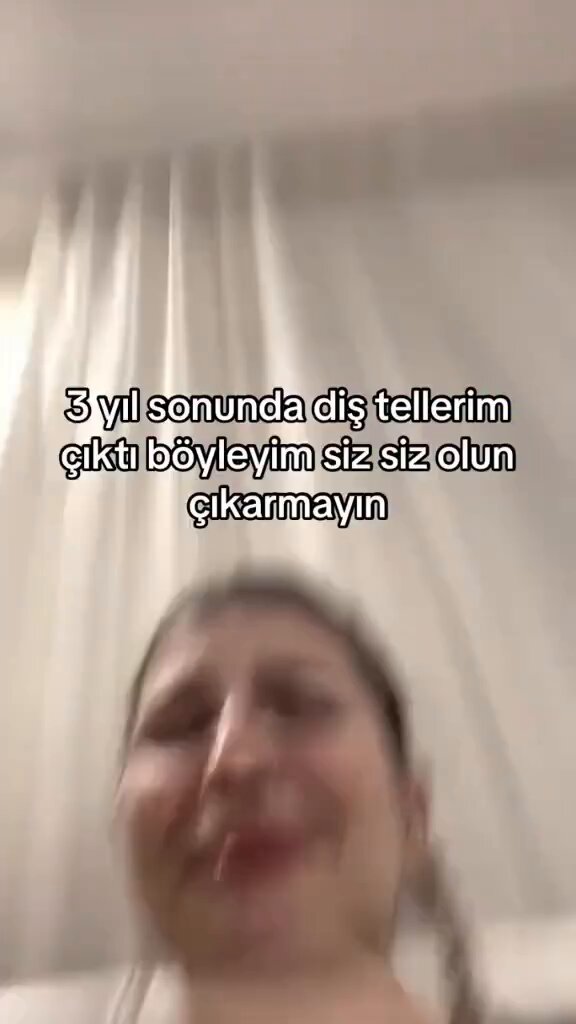 3 yıl sonra diş tellerini çıkartan genç, gözyaşlarına boğuldu. Etrafındakilerin "Altın çocuk" diye dalga geçmesi dikkat çekti.