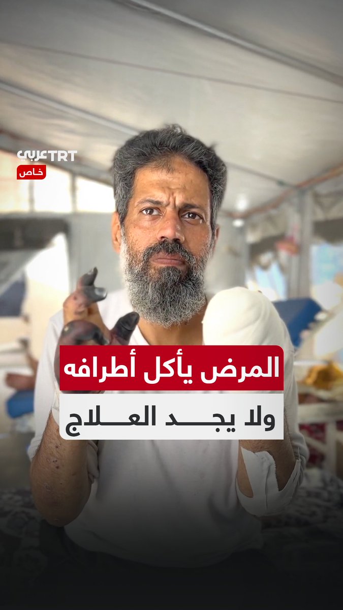 "المرض أكل أطرافي ولا علاج".. مصعب أبو طعيمة من قطاع غزة يروي لـTRT عربي معاناته مع مرض نادر وعدم توافر أي إمكانيات لعلاجه TRT عربي.. #حكايات من الميدان