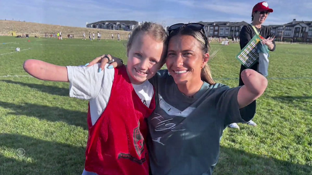 A 9-year-old girl who was born without most of her arm was inspired by a Denver Summit soccer player who is just like her. Steve Hartman is On the Road with a story about role models.