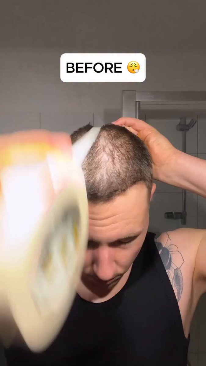 Half bald… half fixed in seconds 😳🔥 this makes no sense