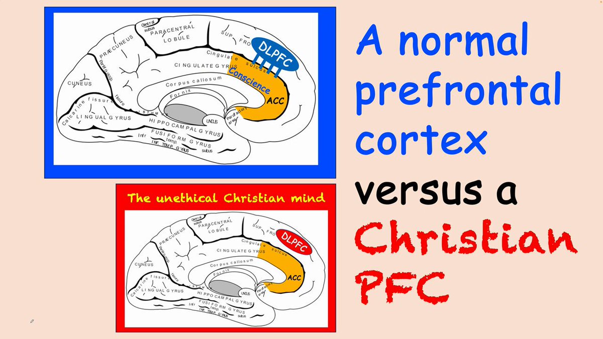 How being a Christian messes up your Pre-Fontal Cortex 👇