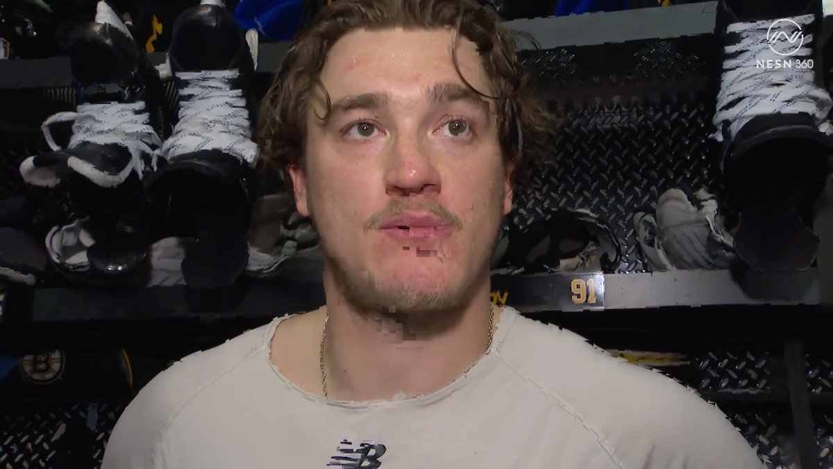 Nikita Zadorov tore his MCL fully off the bone in Game 3 and still finished the series Hockey players are maniacs