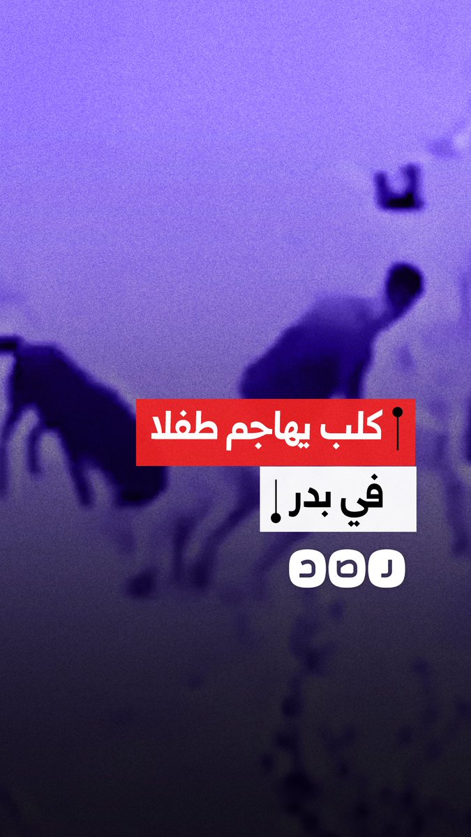 كلب يهاجم طفلا في مدينة بدر بمحافظة القاهرة