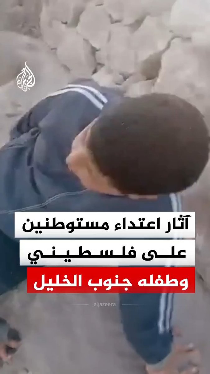 إصابة فلسطيني وطفله إثر اعتداء مستوطنين عليهما بآلات حادة خلال وجودهما في أرضهما بقرية شويكة جنوب الخليل بالضفة الغربية٬ وفق ما ذكرته وكالة الأنباء الفلسطينية وفا #فيديو