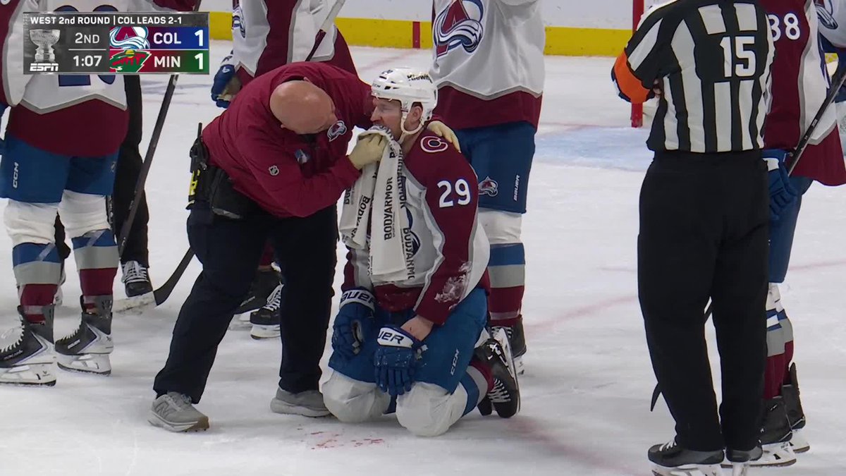 MacKinnon took a puck to the face and was BLEEDING heavy 😳