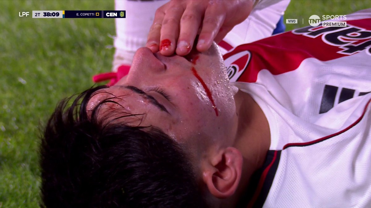 LA DURA PATADA DE COPETTI CONTRA LAUTARO RIVERO EN RIVER VS. ROSARIO CENTRAL 👊🏻 #LPFxTNTSports Viví el Torneo Apertura 2026 por TNT Sports Premium y disfrutalo también en HBO Max 👉 #Suscribite