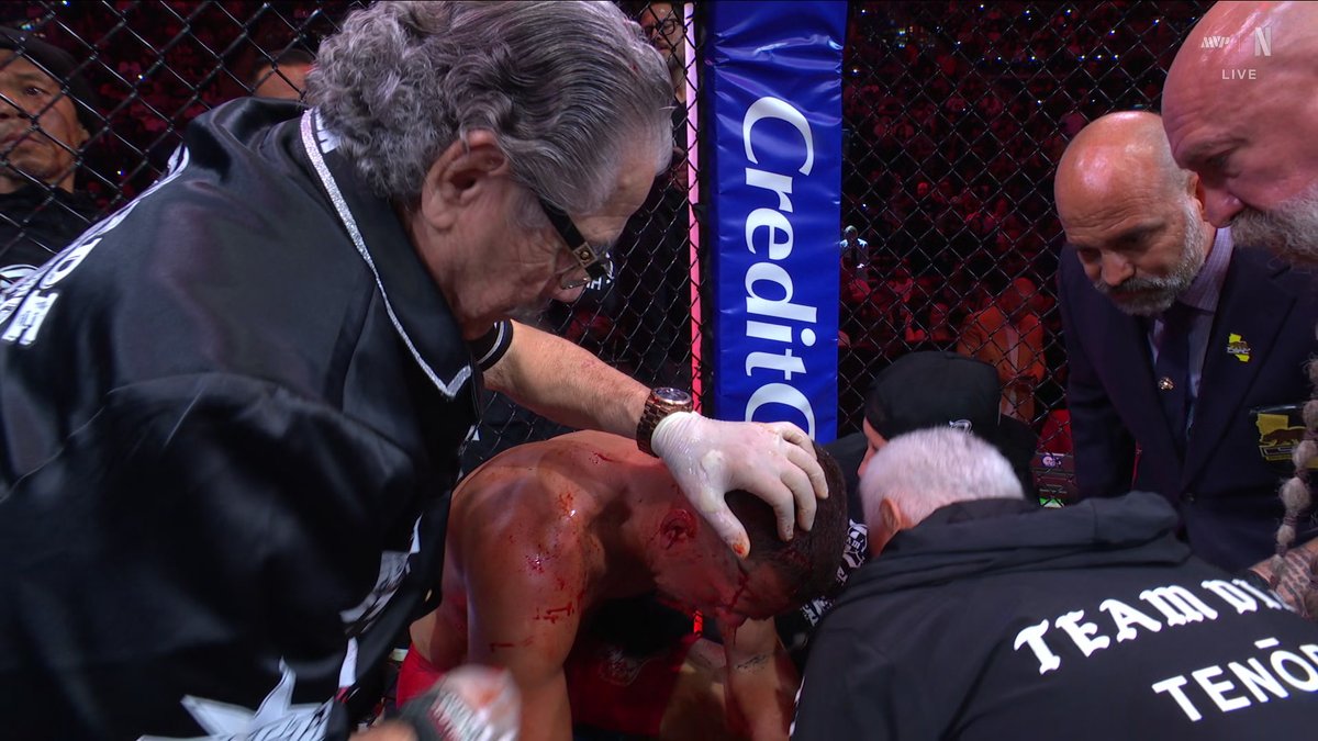 Nate Diaz’s corner just waived off the fight against Mike Perry He was a mess 😳🩸