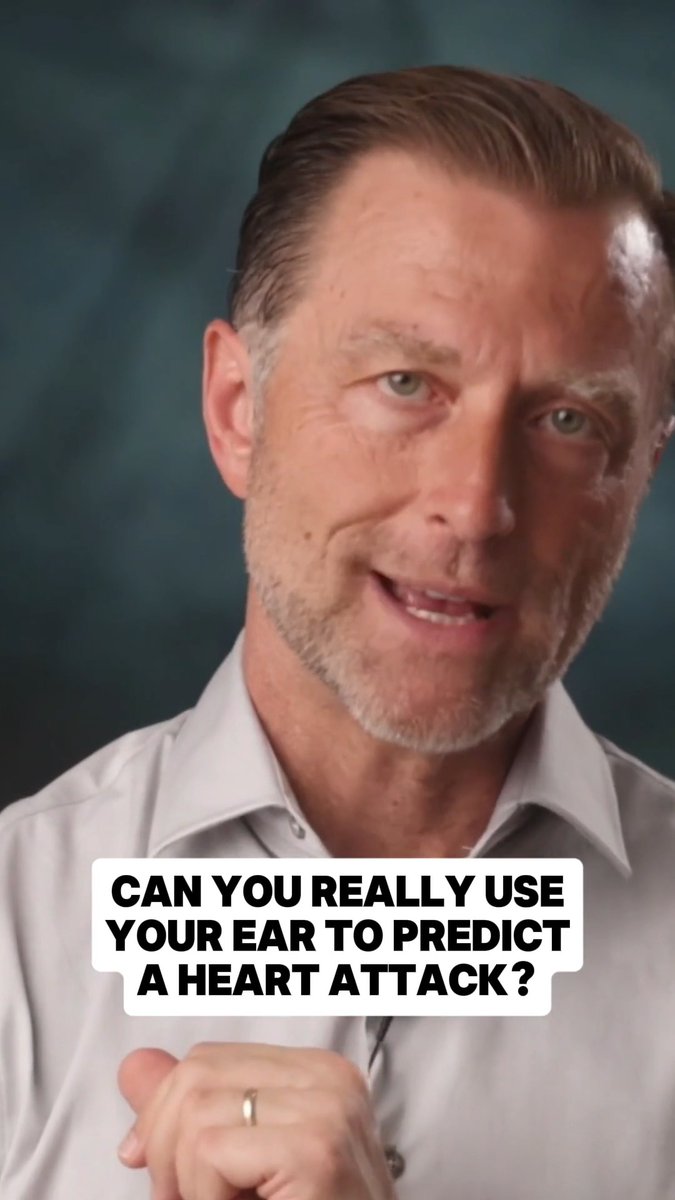 Did you know that you could use your ear to predict a heart attack? Share this with someone it could help. Dr. Eric Berg, DC, not MD; information only