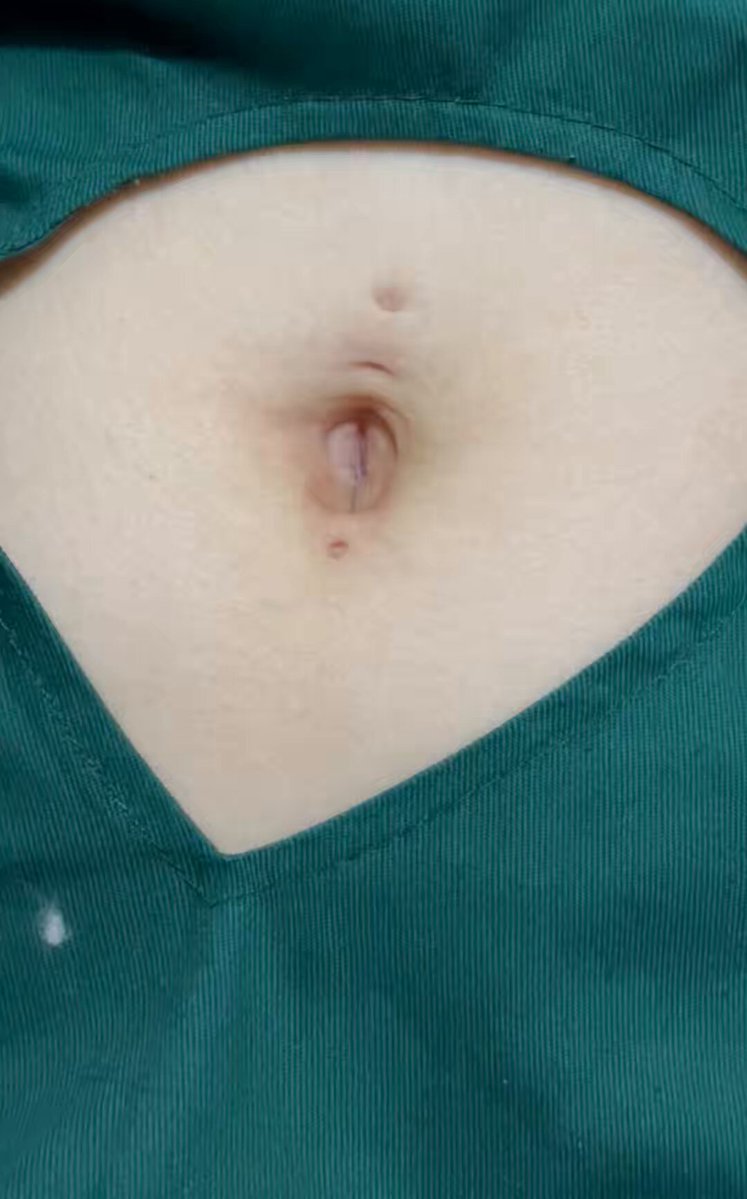 My weekly navel exam 👨‍⚕️ #navel #bellybutton #belly #tummy #fetish #navelexam #ombligo #пупок #肚臍 #へそ