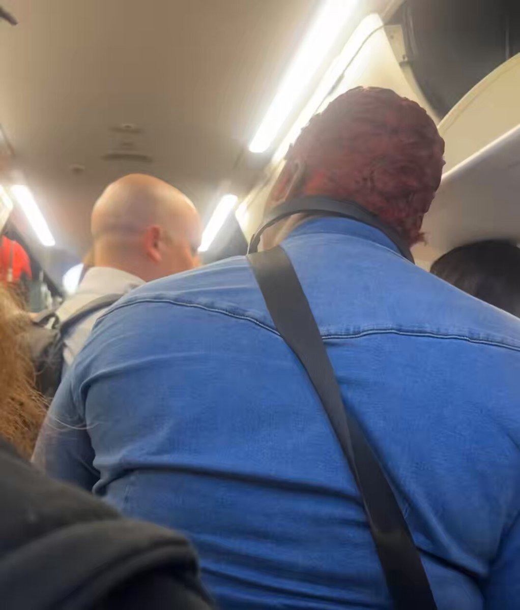 This black woman demands that she be let into the front of the plane before the line even moves. This gentleman behind her expresses his fatigue.