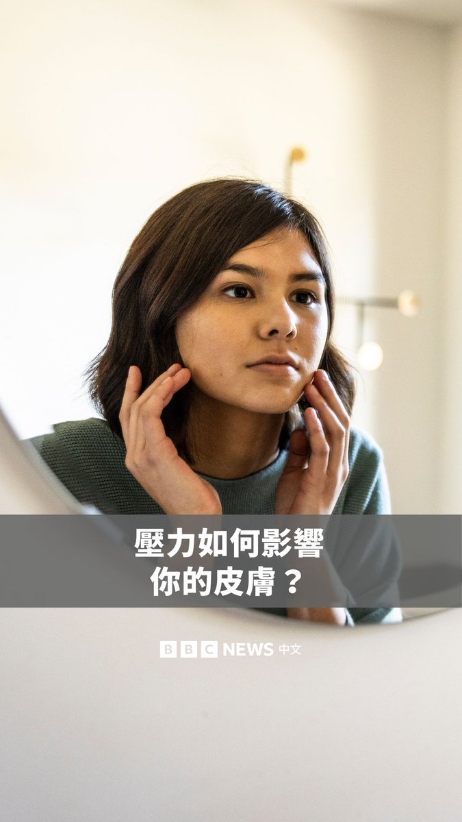 你曾在压力大时出现爆痘、皮肤恶化,或觉得皮肤变得特别敏感吗? 研究显示,压力会启动大脑中的杏仁核,进而让皮肤释放压力相关的化学物质,引发发炎反应。此外,压力荷尔蒙也被认为会刺激皮肤腺体分泌更多皮脂,导致长痘。
