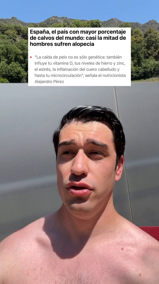 La charocracia es la culpable de que casi la mitad de los hombres sufran alopecia.