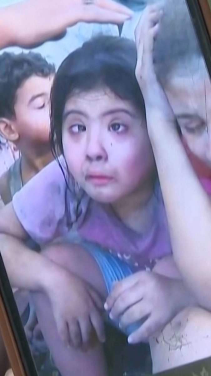 Under a fragile ceasefire in Gaza, children with Down syndrome are trying to adjust to a reality where weapons have largely fallen silent, but over two years of war have made the task ahead challenging.