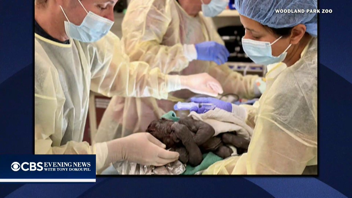 🇺🇸 | Por primera vez en Estados Unidos, los médicos realizaron una cesárea a una gorila en el Zoológico Woodland Park de Seattle.