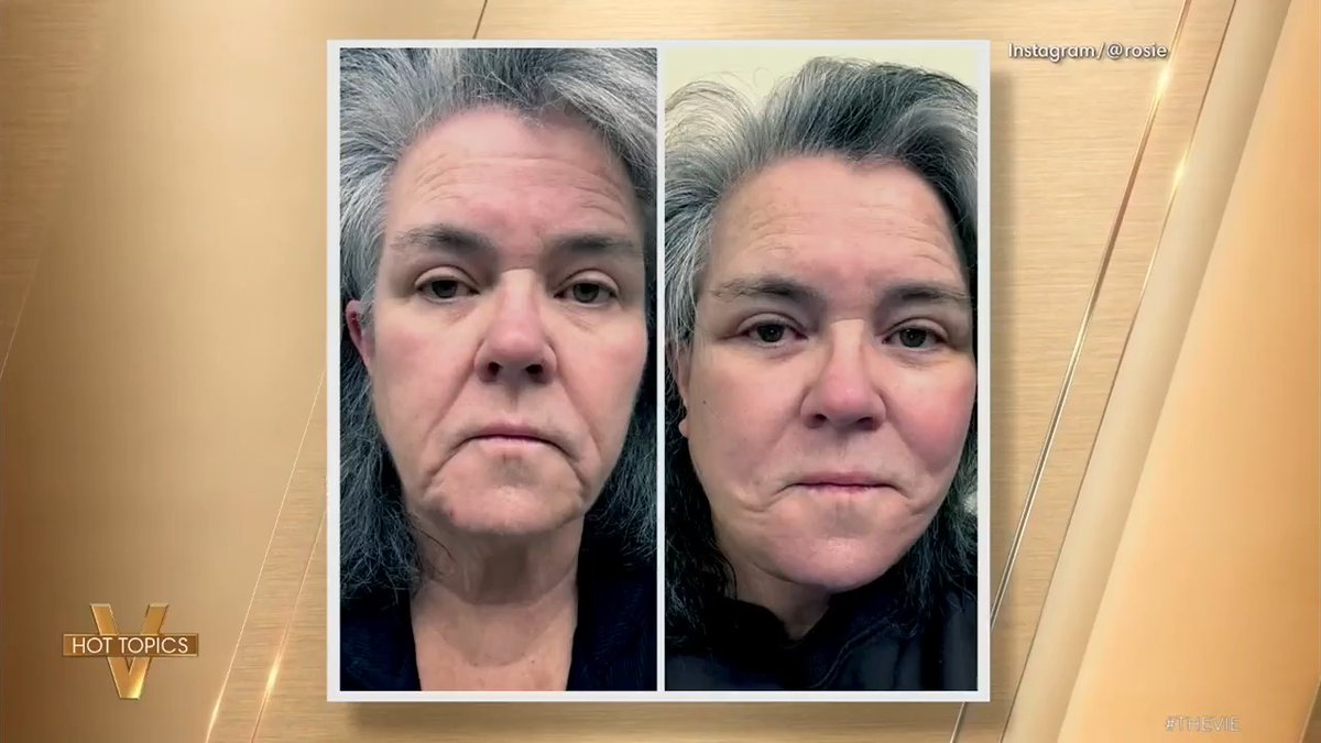 ROSIE O’DONNELL FELT ‘SHAMEFUL’ OVER FACELIFT: 'The View' co-hosts weigh in after O'Donnell shared that she was racked with guilt over her decision to get a facelift.