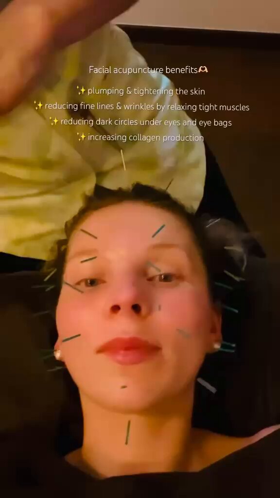 🇯🇵 Japanese Facial Acupuncture… Would you try this? Source: MominJapan YT