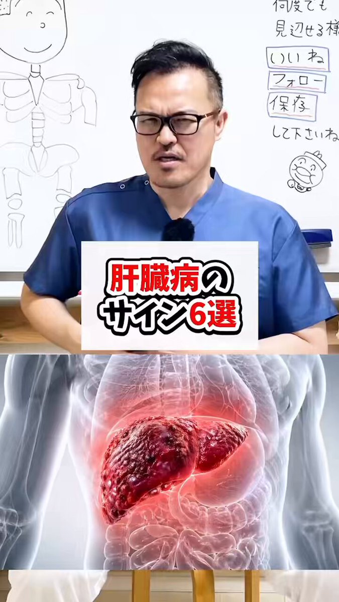 【肝臓の危険なサイン６選】 今すぐチェックして下さいね‼️