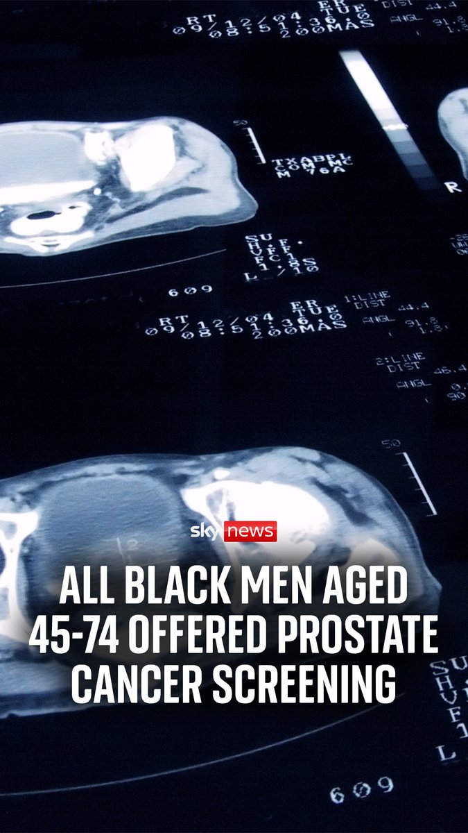 More black men will be offered prostate cancer checks as part of the Transform trial. Black men are known to be at increased risk of prostate cancer - double the risk of other men. #prostatecancer